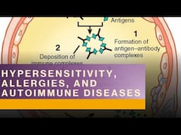 Immune System Hypersensitivities