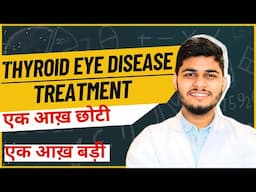 Thyroid Eye Disease | अगर आपकी आंख एक छोटी और दूसरी बड़ी है जानिए कारण, Treatment, Cause