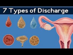 7 Types of Discharge in Women,   You Should NEVER Ignore! 🔥