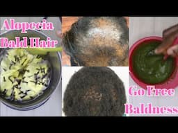 How I Use Clove, Unstoppable Hair Growth, bye bye to hair loss & baldness with clove & moringa