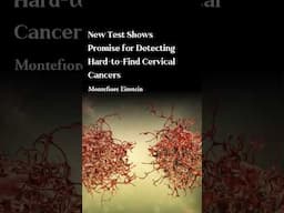 Promising Strides in the Fight Against Cervical Cancer