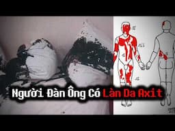 Người Đàn Ông Với LÀN DA AXIT