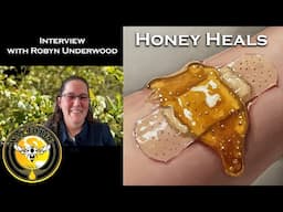 HoneyDew Honey as a Medication, More Potent than Manuka Honey?