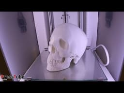 3D Printed Human Skull