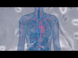 Non-Small Cell Lung Cancer - Yale Medicine Explains