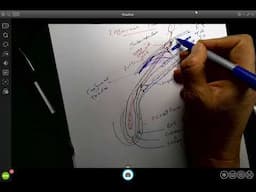 Inguinal canal and hernia MP4