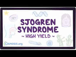 Sjogren syndrome: Pathology review