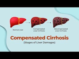 Top Doctor Exposes Compensated Cirrhosis Secrets You Won't Believe