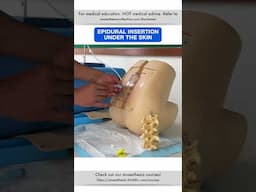 Epidural Insertion Under the Skin | #shorts #cvc #anesthesiology #nurse