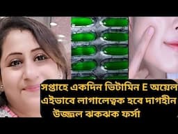 একবার vitamin E এইভাবে লাগিয়ে দেখুন ত্বক হবে দাগহীন ঝকঝকে ফর্সা।।Vitamin E oil for glowing Skin