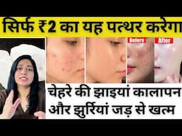 फिटकरी से करे चेहरे की झाइयां, कालापन और झुर्रियां जड़ से ख़त्म | How To Remove Pigmentation At Home |