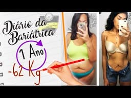 Diario da Bariatrica | 1 ano |  62Kg | UPDATE | Flacidez