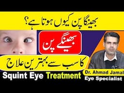 Squint Eyes In Kids Causes,Symptoms And Treatment In Urdu