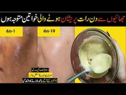 Remove Melasma/Pigmentation 100% At Home: Expert Home Course: Skin Care Tips Pigmented Skin/Face