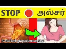 STOP stomach ulcer | 15 Foods give permanent solution | STAR LABORATORY