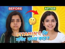 Vitamin C কি সত্যি কাজ করে? | Best Vitamin C Serum for face | Wonder Munna Unplugged