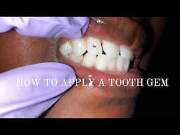 HOW TO APPLY TOOTH GEMS/JEWELRY 💎(updated 2022)