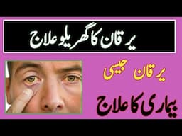 Yarkan ka ilaj || Treatment of Jaundice || Best medicine for Jaundice