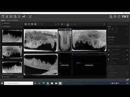 How to Create and Save Layouts for Dental X-Rays in the iM3 Software