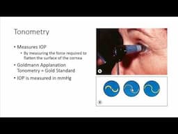 Investigative techniques for glaucoma