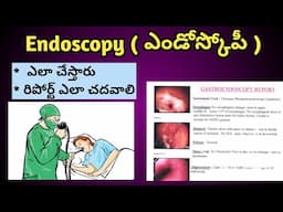 ఎండోస్కోపీ ఎలా చేస్తారు | Endoscopy Detailed Video in Telugu