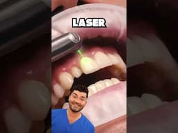 Dental Laser Explained !?