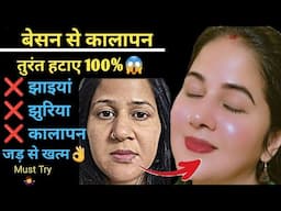 ऐसे लगाओ Besan Skin की सारी मुश्किल आसान: Pigmentation & Dull Skin Treatment