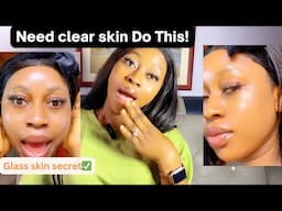 How to get a Clear Skin without spending Money