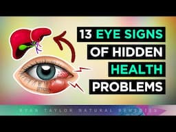 13 Eye Signs of HIDDEN Health Problems