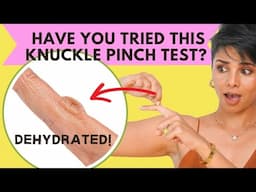 Remedies for Aging KNUCKLES: Make your HANDS Look 10 yrs YOUNGER