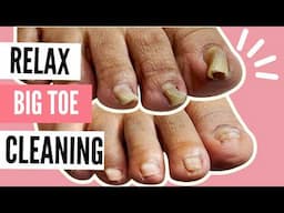 How to Fix Ingrown Toenail Pain