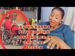 IS THIS KARMA PETE EDOCHIE LOST HIS LEG IN CRITICAL ATTACK