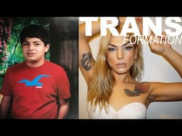 Male to Female transition Transgender timeline