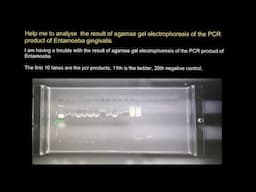 How to analyze result of agarose gel electrophoresis of the PCR product?