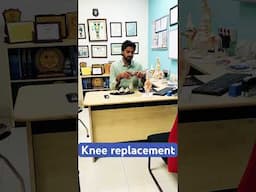 घुटने बदलने में होता क्या है? #doctor #hospital #kneereplacementsurgeon #kneepain #jointpain