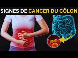 Signes Avant Coureurs Du Cancer Du Côlon Que Vous Ne Devriez Pas Ignorer