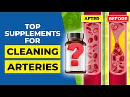 7 Top Supplements for Cleaning Arteries