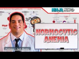 Normocytic Anemia | Clinical Medicine