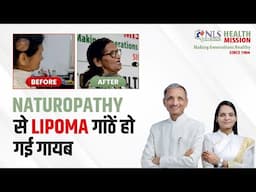 Lipoma, high bp, thyroid, internal piles weakness cured from naturopathy