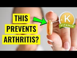 Why Arthritis Sufferers Need More Vitamin K