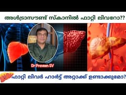 Fatty liver symptoms malayalam | ഫാറ്റി ലിവർ | Fatty liver malayalam |Fatty liver malayalam tips