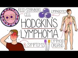 Hodgkin's Lymphoma Explained (With Classification)