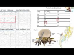 Neuromonitoring - 7/16/2024