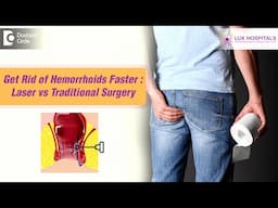 Piles| Get rid of PILES Fast| Laser vs Traditional Hemorrhoidectomy #piles-Dr.Samhitha Reddy Marpali