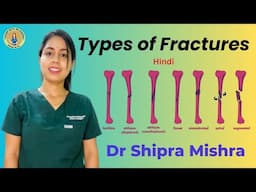 Types of Fractures in hindi | fracture treatment | bone Fracture| Fracture types and mangment