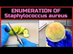 Enumeration of Staphylococcus aureus in Food | A Complete Procedure | BAM, Chapter-12