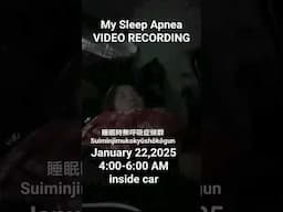 Sleep Apnea