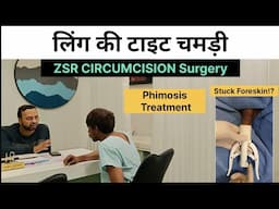 Circumcision In Bangalore | Zsr circumcision Surgery Cost In Bangalore | Zenith Clinic