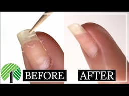 Fix a Broken Nail with Household Items! | Nail Repair Hack WITHOUT a Tea Bag