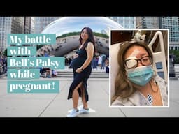 My Sudden Bell's Palsy Diagnosis while Pregnant at 40 - Chef Julie Yoon